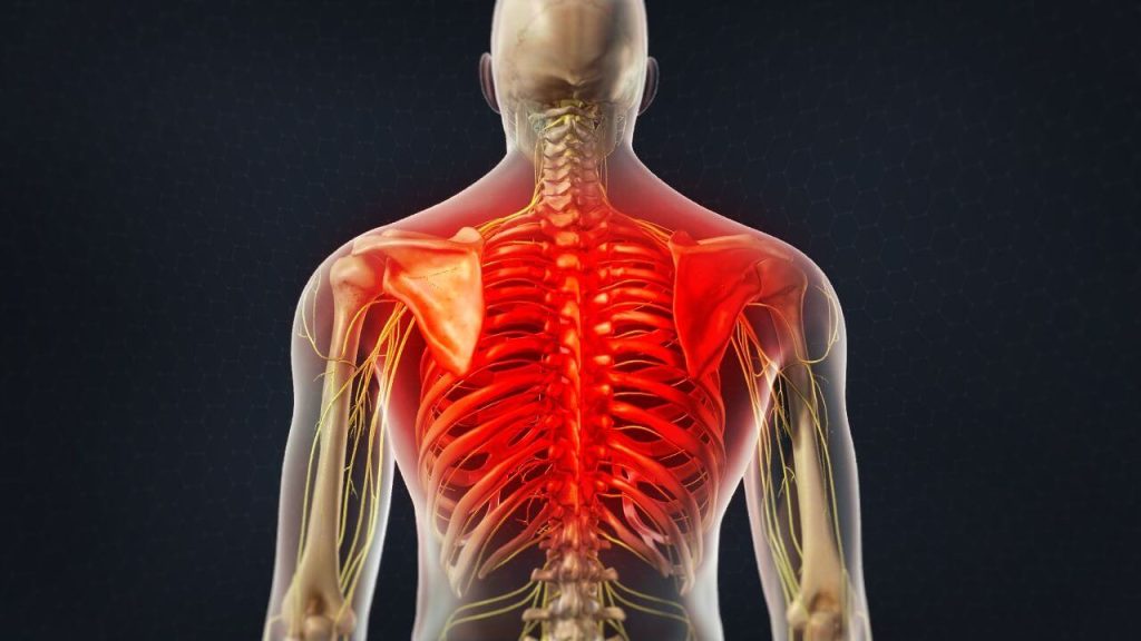 Pain in the upper or mid back