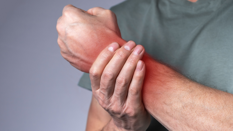 Mechanical Diagnosis and Therapy for Persistent Wrist Pain